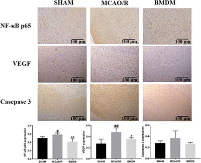 Serum and brain metabolomic study reveals the protective effects of Bai-Mi-Decoction on rats with ischemic stroke